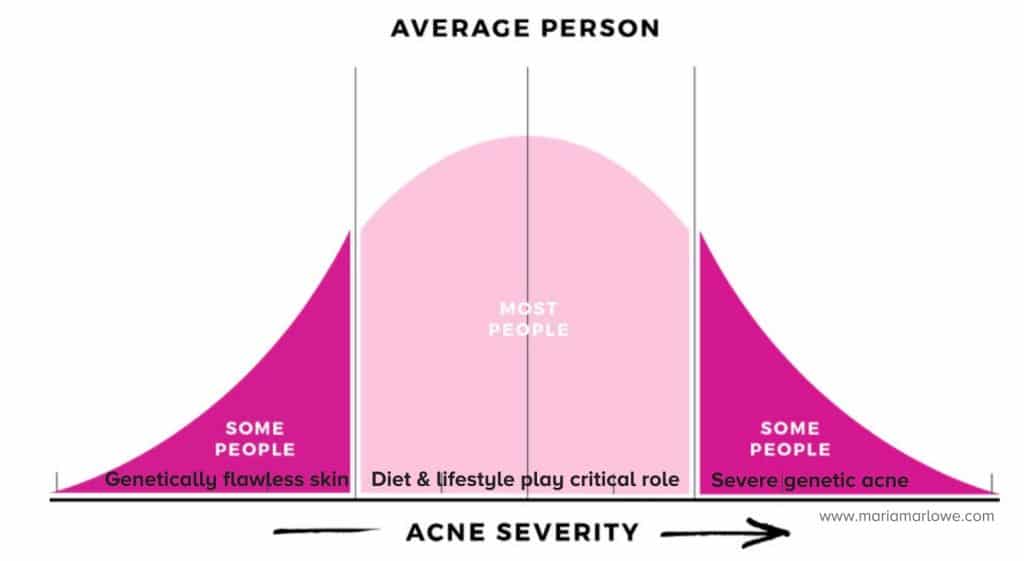 Role of Diet and lifestyle for acne 