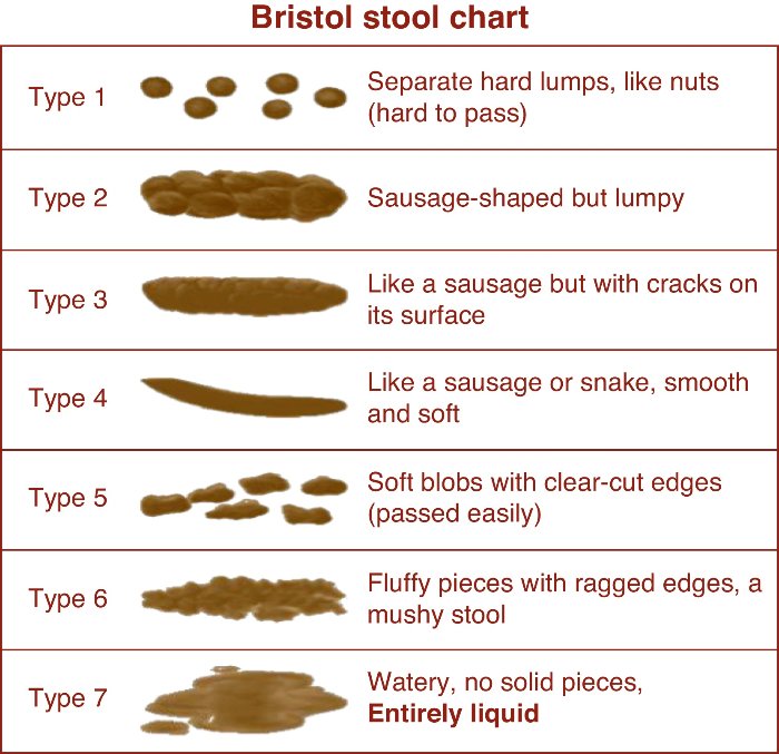 https://mariamarlowe.com/wp-content/uploads/2017/12/Bristol-stool-chart1.jpg